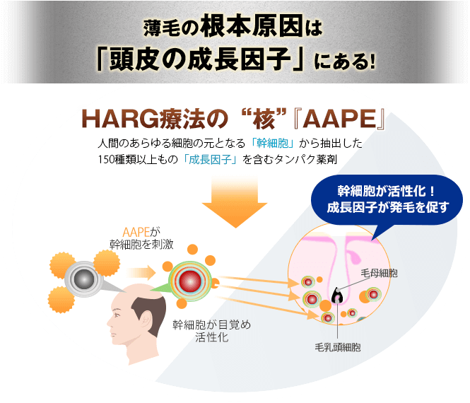 HARG療法の核「AAPE」